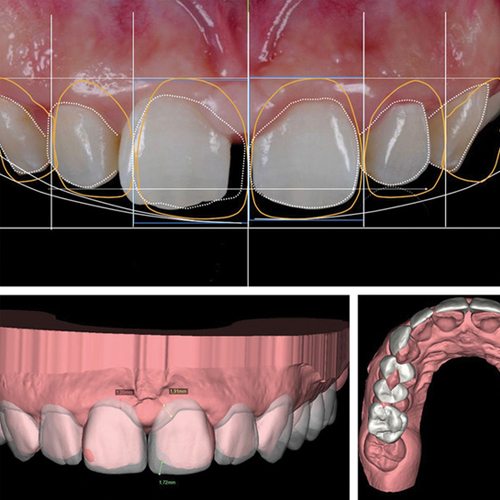 Digital Smile Design